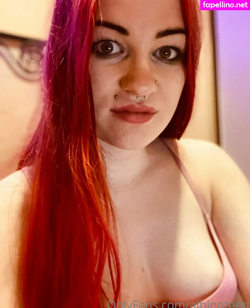 Albinoteen Leaked Nude Picture #OfhAz2OuTV