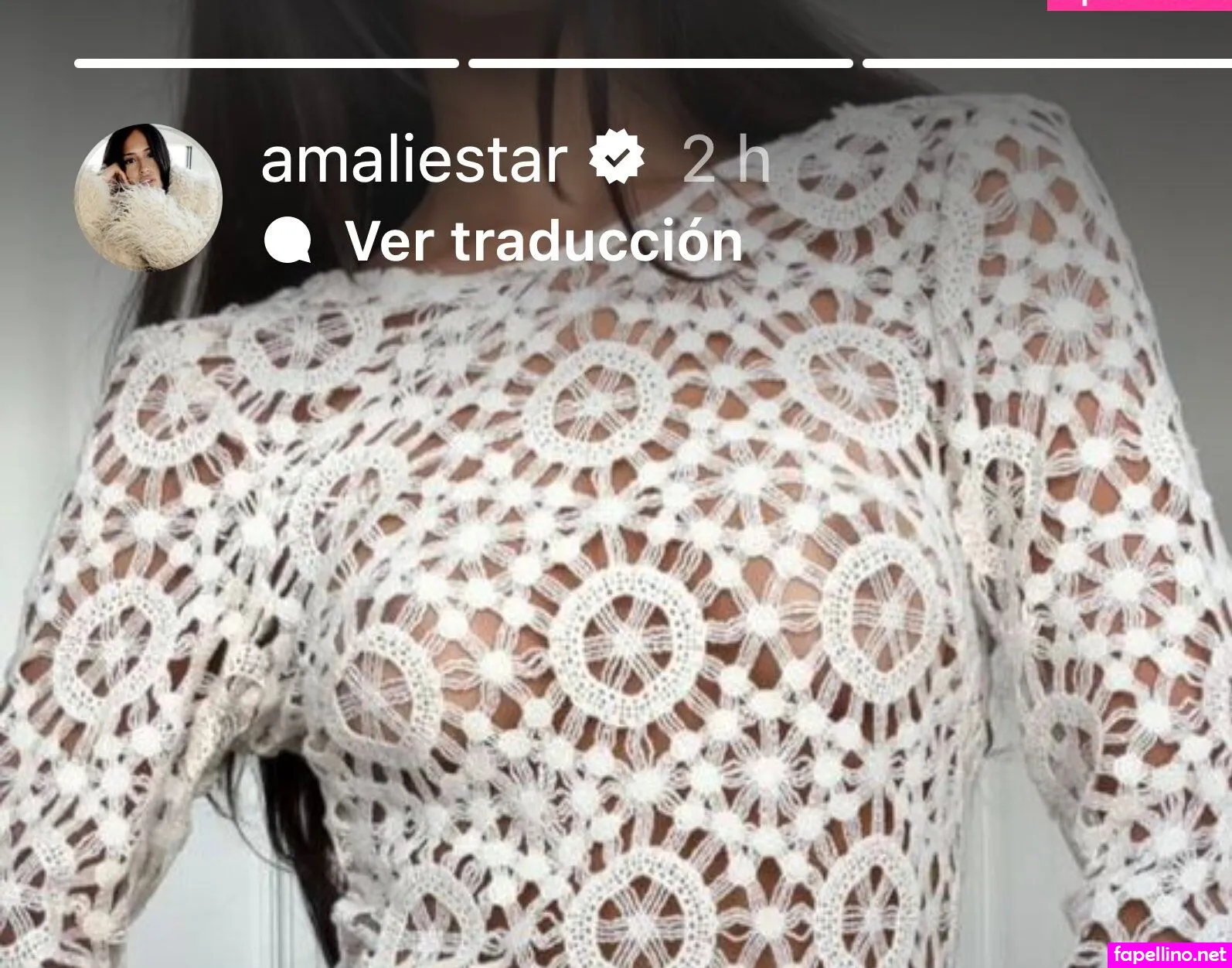 Amaliestar Leaked Nude Picture #qTYM3NdKJt