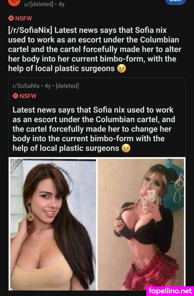 Before and After : Pornstar Boobjobs, _celebrities_before_after_ Leaked Nude Picture #qrBoxOy9XF