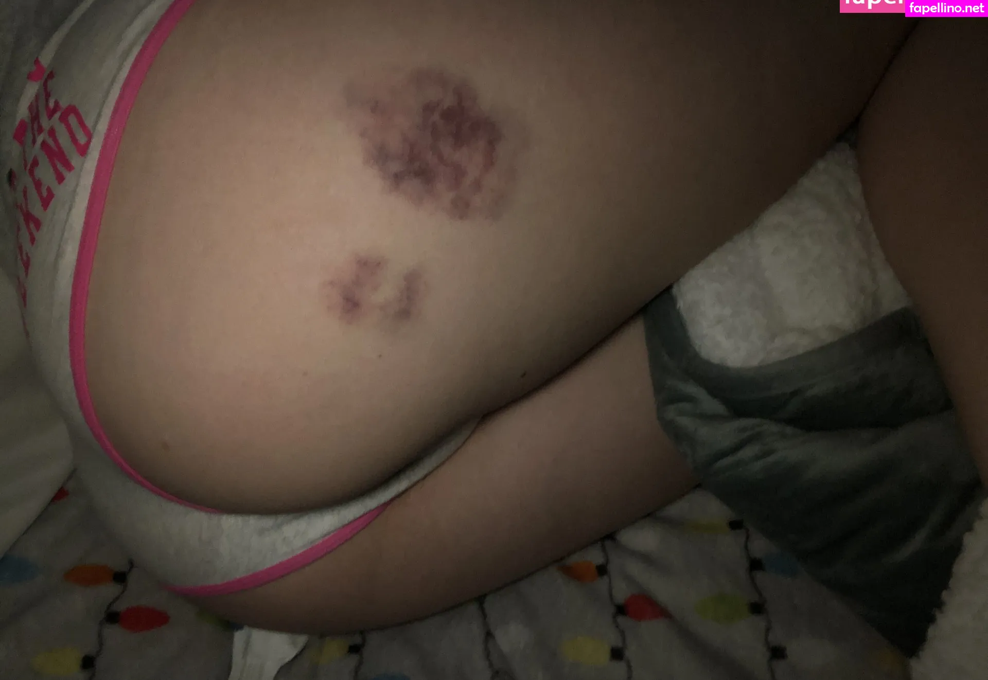 Bleeding.bubblegum, bleedingbubblegum Leaked Nude Picture #V9J9h7MlEx