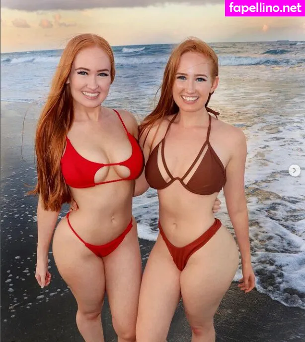 Ashley e Kayley, GÃªmeas Burinski, ashleyburinski Leaked Nude Picture #CYNwkgHxDX