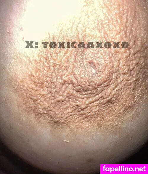 Toxicaaxoxo Leaked Nude Picture #TXryhm74k3