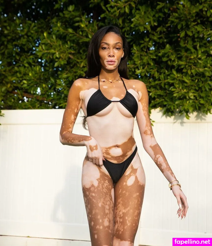 Winnieharlow Leaked Nude Picture #s8y4lRfNZx